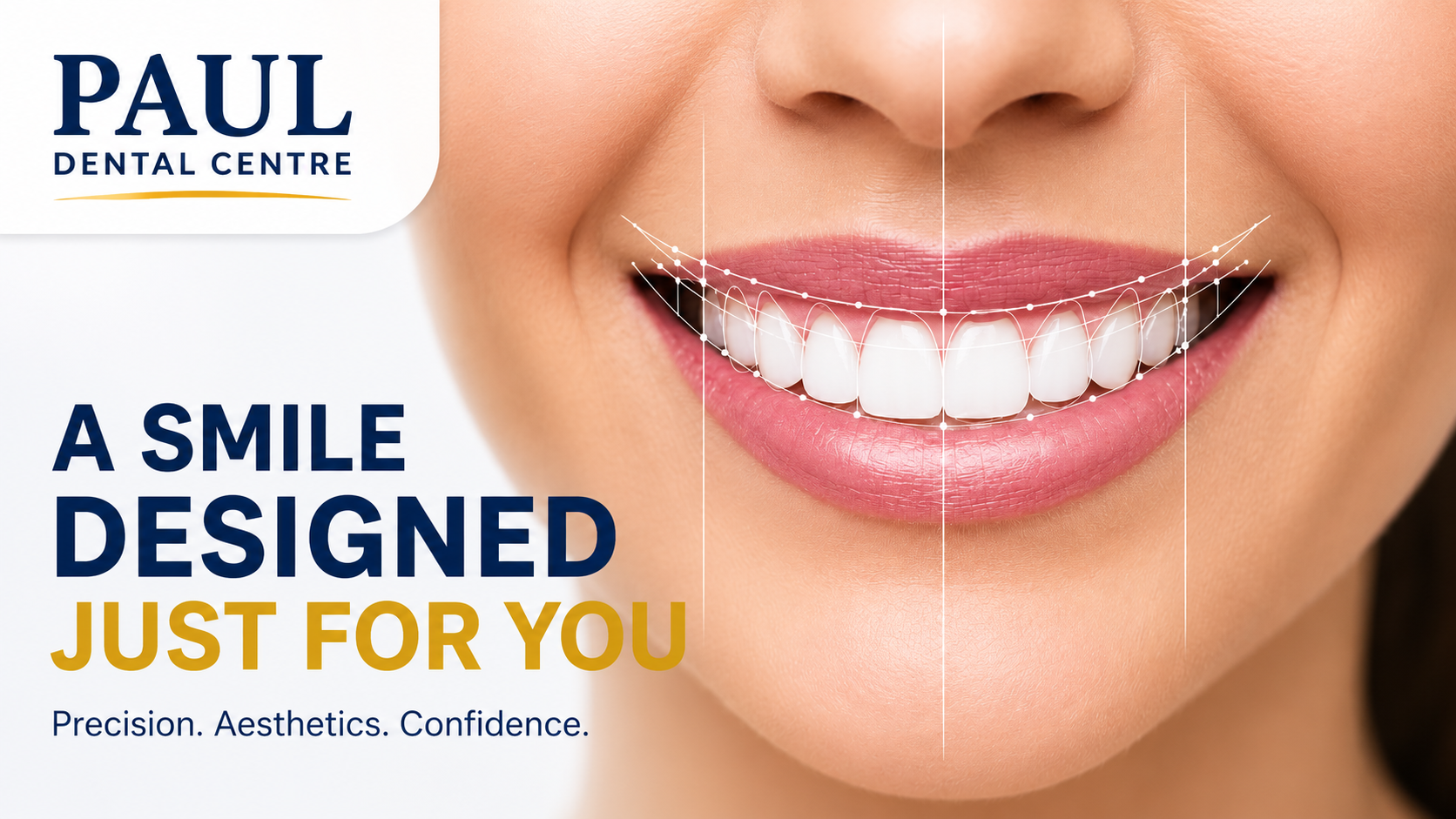 Full Smile Makeovers